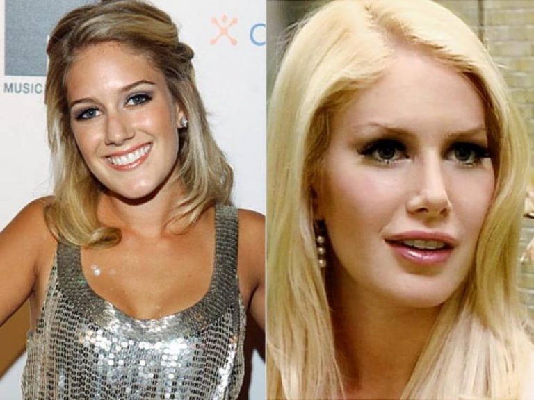 The Ever Changing Look Of Heidi Montags Before And After Plastic Surgery Just Gaming